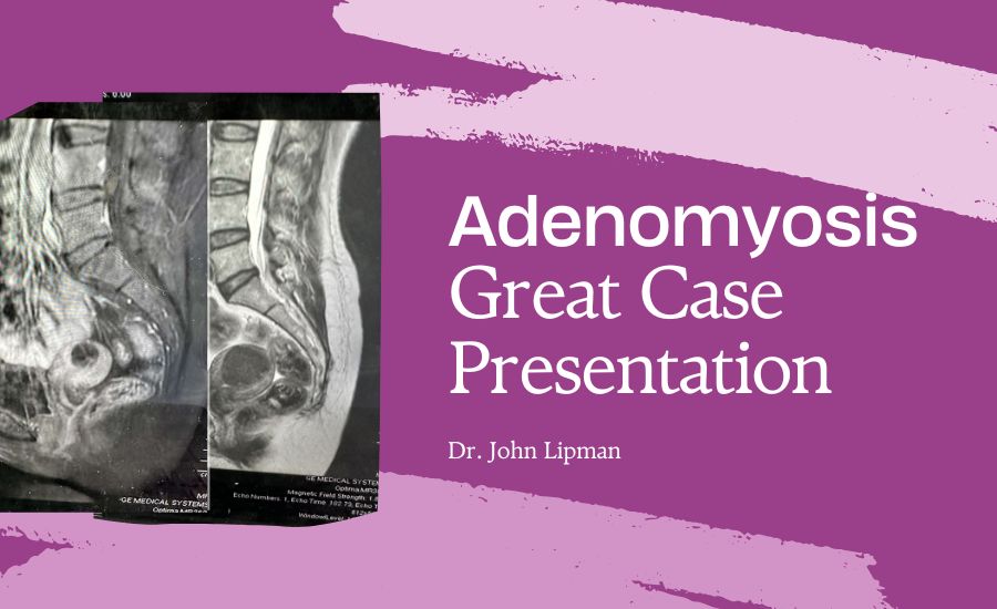 Adenomyosis Great Case Presentation