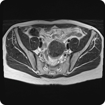 Case image 1