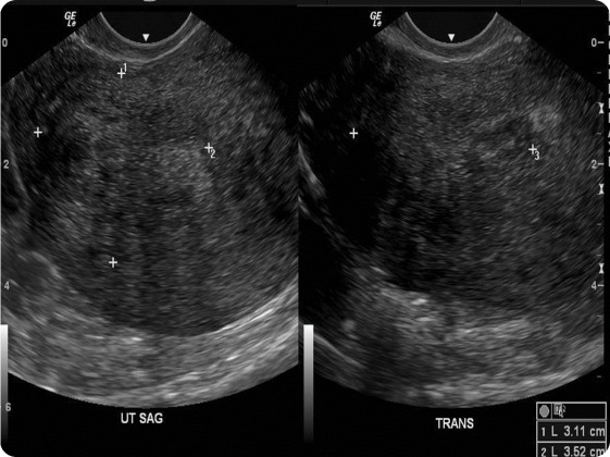 Case image 1