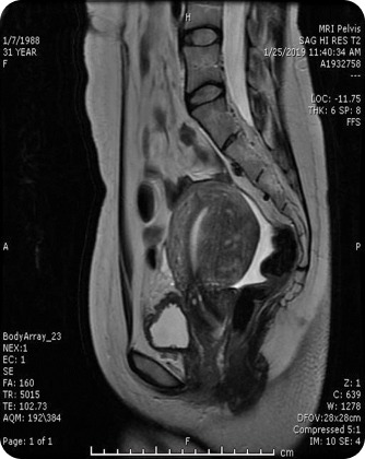 Case image 1
