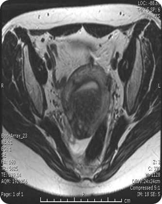 Case image 2