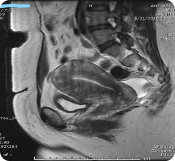 Case image 1