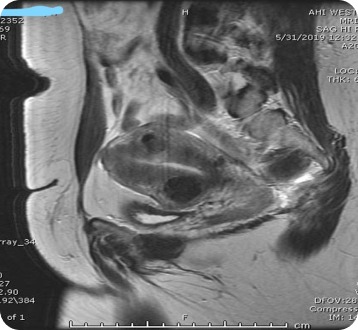 Case image 2