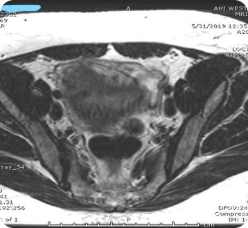 Case image 1