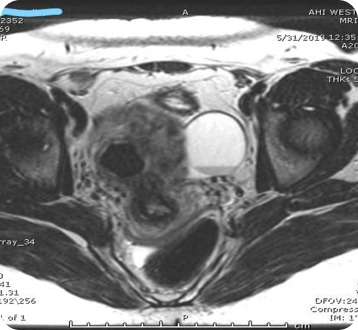 Case image 2