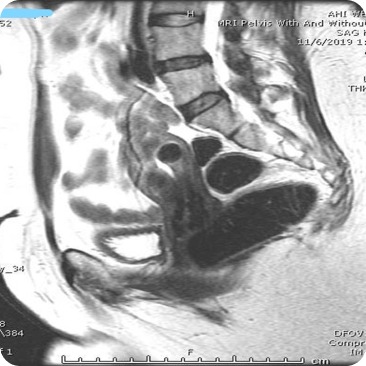 Case image 1
