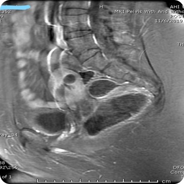 Case image 2