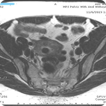 Case image 1