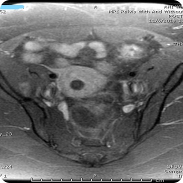 Case image 2