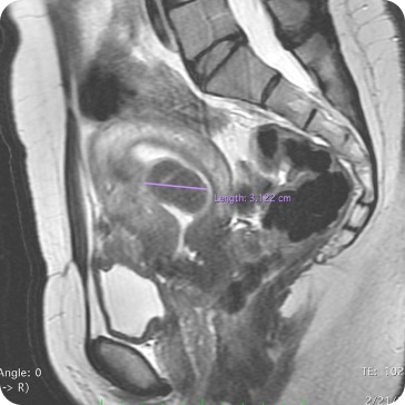Case image 1