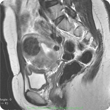 Case image 2