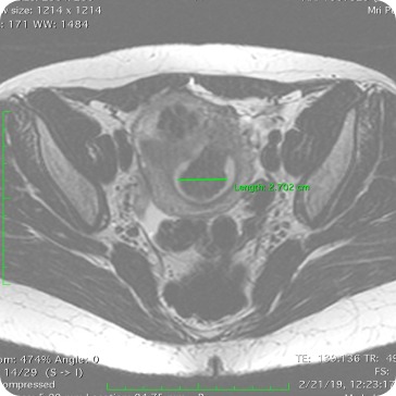 Case image 1