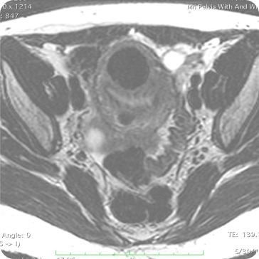 Case image 2