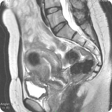 Case image 1