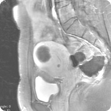 Case image 2