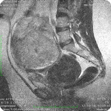 Case image 1