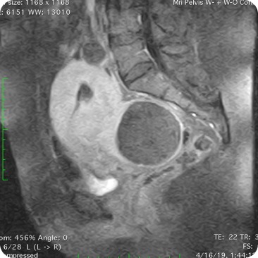 Case image 2