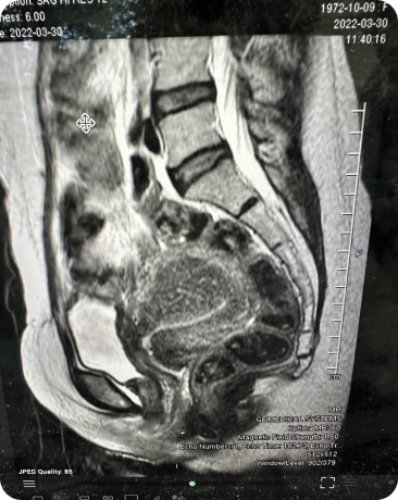 Case image 1