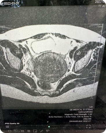 Case image 2