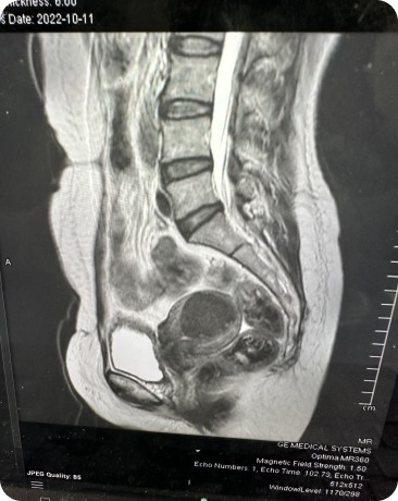 Case image 1