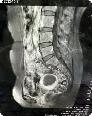 Case image 2