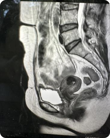 Case image 1