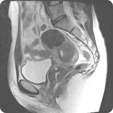Case image 1