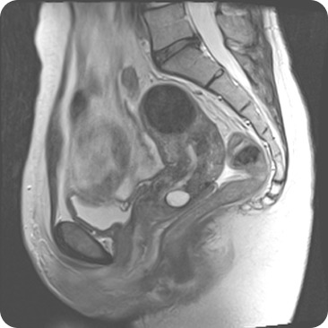 Case image 1