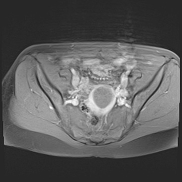 Case image 2
