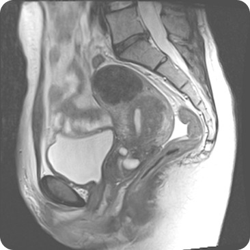 Case image 1