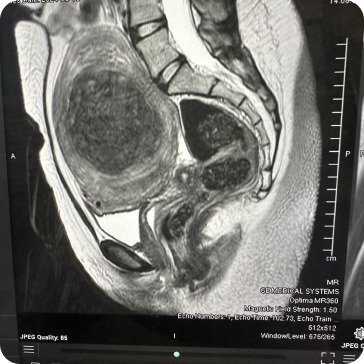 Case image 1