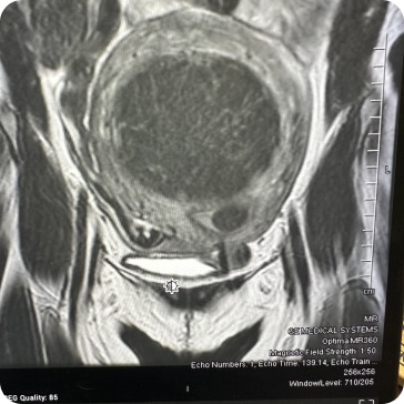 Case image 2