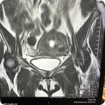 Case image 1
