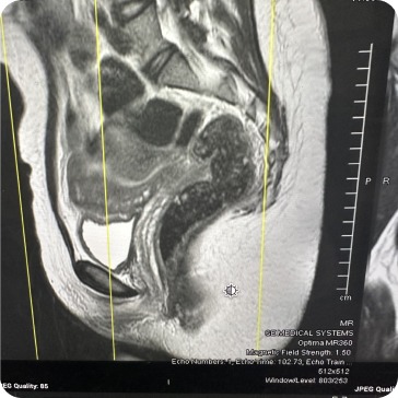 Case image 2