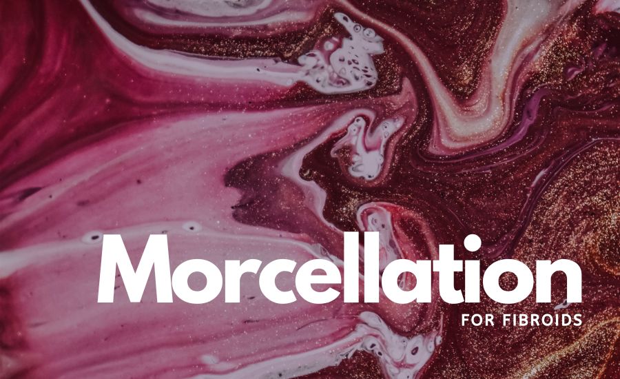 Morcellation for Fibroids