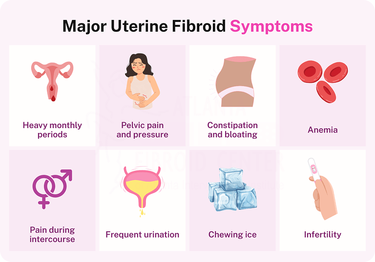 Major symptoms of uterine fibroids